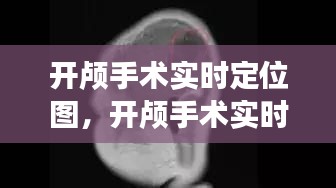 开颅手术实时定位图，开颅手术实时定位图解 