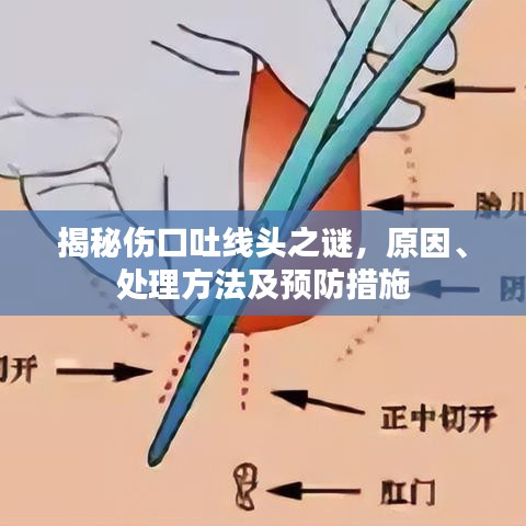 揭秘伤口吐线头之谜，原因、处理方法及预防措施