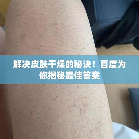 解决皮肤干燥的秘诀！百度为你揭秘最佳答案
